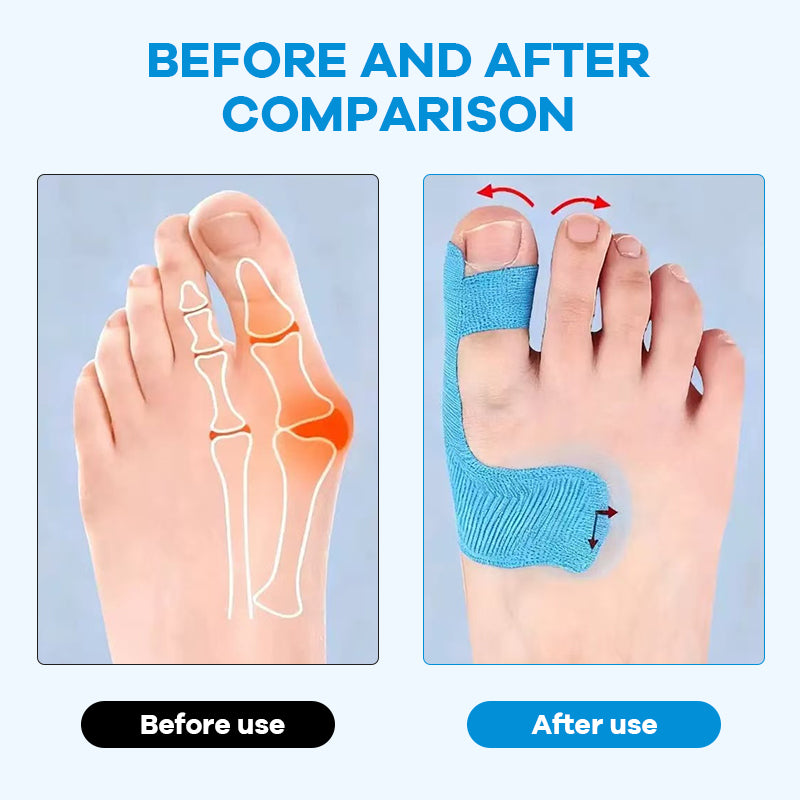 Vorgeschnittenes Hallux-Valgus Tape für Alltagsschuhe